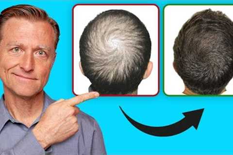 How to Regrow Your Hair (UPDATED VITAL INFO)